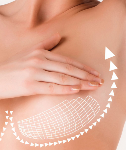 Breast lift (Mastopexy): Procedure, Purpose, Results, Cost, Price